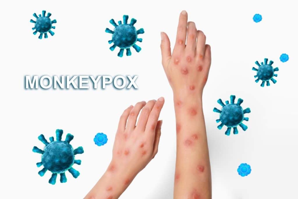 Monkeypox Vaccination